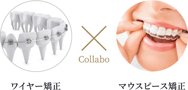 ワイヤー矯正 Collabo マウスピース矯正