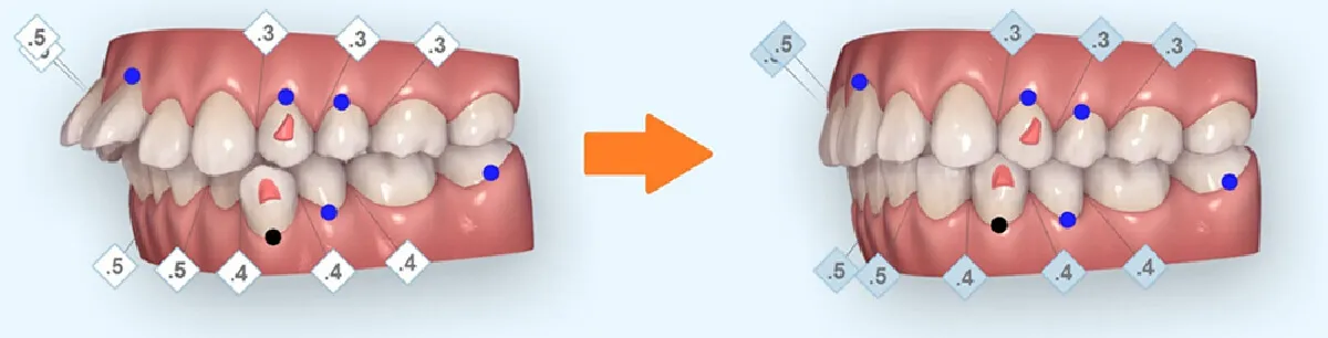 メリット2. 治療ゴールを確認できる