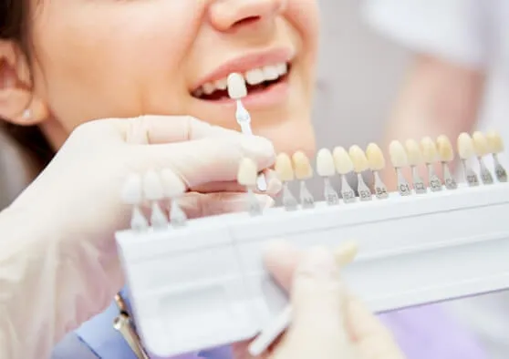 オフィスホワイトニング