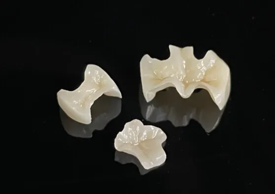 オールセラミック