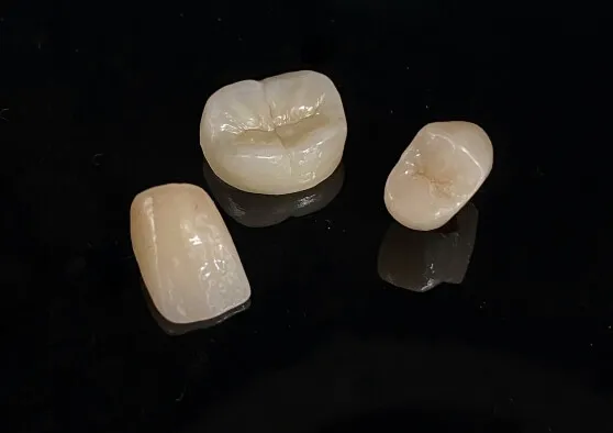 オールセラミック