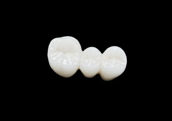 オールセラミック