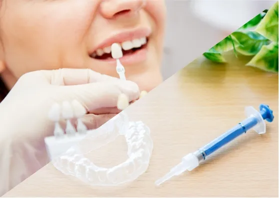 ブリリアントホワイトニング